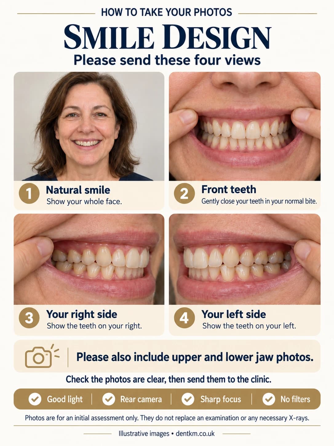 How to take your photos for a smile design: natural smile, front teeth, right side and left side