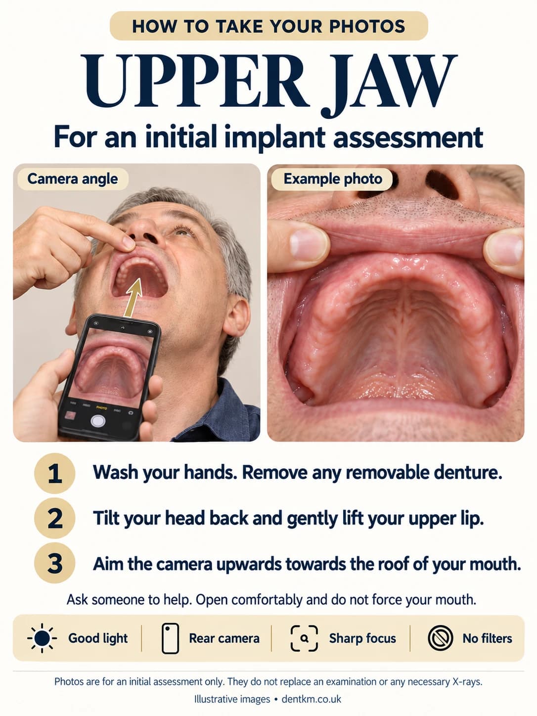 How to photograph your upper jaw: tilt your head back, lift your upper lip and aim the camera upwards